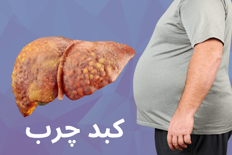 کبد چرب چیست ؟ هر چیزی که باید در مورد کبد چرب بدانید